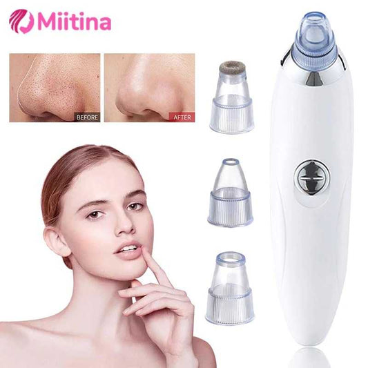 Electric Blackhead Remover — Deep Pore Vacuum Cleanser | Clearer, Smoother Skin